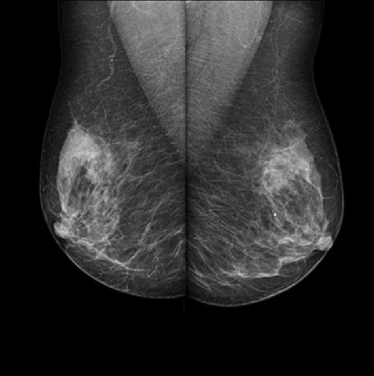 MX-600 · Clinical images 2